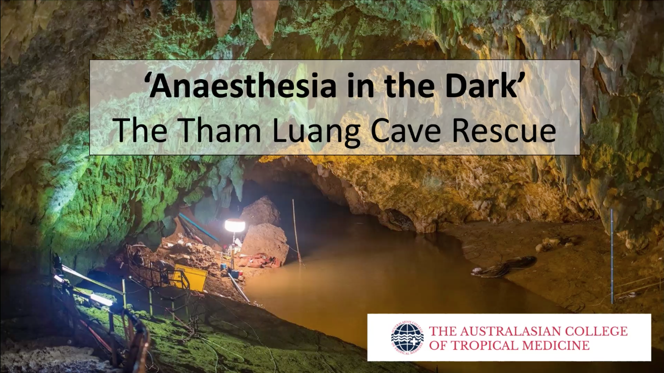 Anaesthesia in the Dark April 2022 ACTM webinar